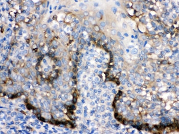 IHC testing of FFPE human tonsil with ZAP70 antibody. HIER: Boil the paraffin sections in pH 6, 10mM citrate buffer for 20 minu