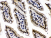 IHC testing of FFPE mouse intestine with CRM1 antibody. Boil the paraffin sections in pH 6, 10mM citrate buffer for 20 minutes and allow to cool prior to testing.