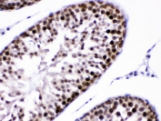 IHC testing of FFPE rat testis with CRM1 antibody. Boil the paraffin sections in pH 6, 10mM citrate buffer for 20 minutes and allow to cool prior to testing.