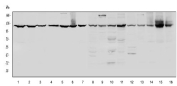 Western blot testing of 1) human HeLa, 2) human COLO-320, 3) human MCF7, 4) human A549, 5) human A431, 6) human SGC-7901, 7) human 22RV1, 8) rat heart, 9) rat skeletal muscle, 10)  rat lung, 11) rat testis, 12) mouse heart, 13) mouse skeletal muscle, 14) mouse lung, 15) mouse testis and 16) mouse ovary tissue lysate with CRM1 antibody. Expected/observed molecular weight ~123 kDa.