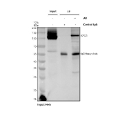 Immunoprecipitation of CRM1 protein from 500ug of human HeLa whole cell lysate with 2ug of CRM1 antibody.