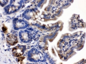 IHC testing of FFPE mouse intestine with Talin 2 antibody. HIER: Boil the paraffin sections in pH 6, 10mM citrate buffer for 20 minutes and allow to cool prior to testing.