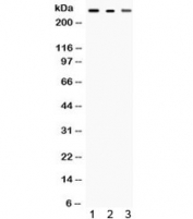 Western blot testing of 1) rat brain, 2) mouse heart and 3) human SMMC-7721 lysate with Talin 2 antibody. Expected/observed molecular weight ~271 kDa.