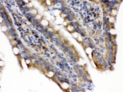 IHC testing of FFPE rat intestine with Talin 2 antibody. HIER: Boil the paraffin sections in pH 6, 10mM citrate buffer for 20 minutes and allow to cool prior to testing.