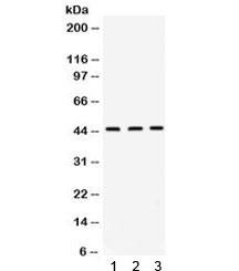 Western blot testing of 1) rat liver, 2) mouse liver and 3) human PANC lysate with ORM1 antibody. Expected molecular weight: 24/41-60 kDa (unmodified/glycosylated).~