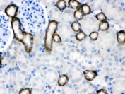 IHC testing of FFPE mouse kidney with Calcium Sensing Receptor antibody. HIER: Boil the paraffin sections in pH 6, 10mM citrate buffer for 20 minutes and allow to cool prior to testing.