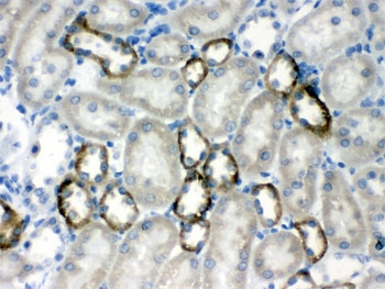 IHC testing of FFPE rat kidney with Calcium Sensing Receptor antibody. HIER: Boil the paraffin sections in pH 6, 10mM citrate buffer for 20 minutes and allow to cool prior to testing.
