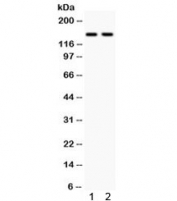 Western blot testing of human 1) HeLa and 2) 22RV1 cell lysate with Calcium Sensing Receptor antibody. Predicted molecular weight ~121 kDa, but is routinely observed at up to ~160 kDa.