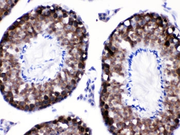 IHC testing of FFPE mouse testis with SIP antibody. HIER: Boil the paraffin sections in pH 6, 10mM citrate buffer for 20 minutes and allow to cool prior to testing.