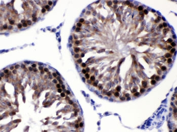 IHC testing of FFPE rat testis with SIP antibody. HIER: Boil the paraffin sections in pH 6, 10mM citrate buffer for 20 minutes and allow to cool prior to testing.