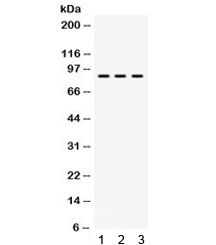 Western blot testing of 1) rat brain, 2) mouse spleen and 3) human U87 lysate with AFG3L2 antibody. Expected/observed molecular weight ~89 kDa.