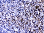 IHC testing of FFPE mouse lymph node with anti-Cd2 antibody. HIER: Boil the paraffin sections in pH 6, 10mM citrate buffer for 20 minutes and allow to cool prior to testing.