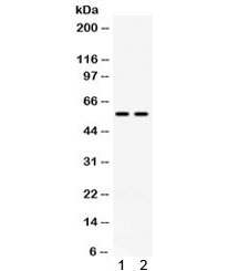 Western blot testing of mouse 1) heart and 2) HEPA lysate with anti-Cd2 antibody. Predicted molecular weight: 38/50 kDa (unmodified/glycosylated).~