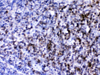 IHC testing of FFPE mouse lymph node with anti-Cd2 antibody. HIER: Boil the paraffin sections in pH