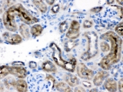 IHC testing of FFPE mouse kidney with TCP1 delta antibody. HIER: Boil the paraffin sections in pH 6, 10mM citrate buffer for 20 minutes and allow to cool prior to testing.