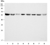 Western blot testing of 1) human HeLa, 2) human U-2 OS, 3) human SW620, 4) human MCF7, 5) rat brain, 6) rat liver, 7) mouse brain and 8) mouse liver tissue lysate with TCP1 delta antibody. Predicted molecular weight ~58 kDa.