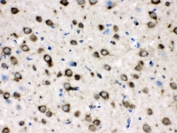 IHC testing of FFPE rat brain with TCP1 delta antibody. HIER: Boil the paraffin sections in pH 6, 10mM citrate buffer for 20 minutes and allow to cool prior to testing.