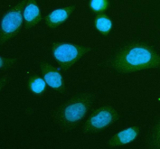 IF/ICC staining of FFPE human SiHa cells with TCP1 delta antibody (green) and DAPI nuclear stain (blue) at 2ug/ml. HIER: steam section in pH6 citrate buffer for 20 min.