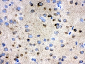 IHC testing of frozen rat brain tissue with TCP1 antibody.