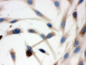 ICC testing of FFPE human SHG-44 cells with TCP1 delta antibody.