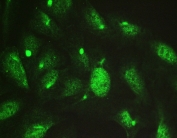 IF/ICC staining of FFPE human U-2 OS cells with TCP1 delta antibody (green) at 2ug/ml. HIER: steam section in pH6 citrate buffer for 20 min.