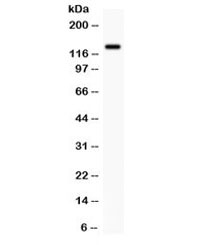 Western blot testing of human SW620 cell lysate with CDCP1 antibody. Expected molecular weight: 93 kDa (unmodified), 130-140 kDa (glycosylated), ~70 kDa (cleaved).