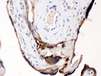 IHC testing of FFPE human placenta with CDCP1 antibody. HIER: Boil the paraffin sections in pH 6, 10mM citrate buffer for 20 minutes and allow to cool prior to testing.