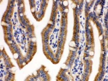 IHC testing of FFPE mouse intestine with CDCP1 antibody. HIER: Boil the paraffin sections in pH 6, 10mM citrate buffer for 20 minutes and allow to cool prior to testing.