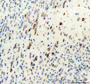 IHC staining of FFPE mouse brain tissue with CGRP antibody, HRP-secondary and DAB substrate. HIER: boil tissue sections in pH8 EDTA for 20 min and allow to cool before testing.