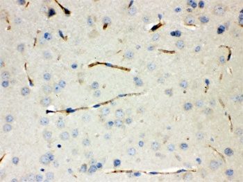 IHC testing of FFPE mouse lung with CGRP antibody. HIER: Boil the paraffin sections in pH 6, 10mM citrate buffer for 20 minutes and allow to cool prior to testing.~
