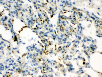 IHC testing of FFPE rat lung with CGRP antibody. HIER: Boil the paraffin sections