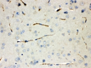IHC testing of FFPE mouse lung with CGRP antibody. HIER: Boil the paraffin sections in pH 6, 10mM citrate buffer for 20 minutes and allow to cool prior to testing.