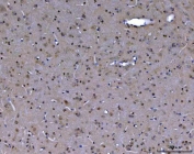 IHC testing of FFPE mouse brain tissue with ABL2 antibody. HEIR: Boil the paraffin sections in pH8 EDTA buffer for 20 minutes and allow to cool prior to testing.