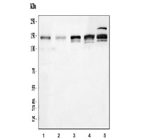 Western blot testing of 1) rat brain, 2) rat PC-12, 3) mouse brain, 4) mouse NIH 3T3 and 5) human K562 cell lysate with ABL2 antibody. Expected molecular weight ~128 kDa, but routinely observed at 128-140 kDa.