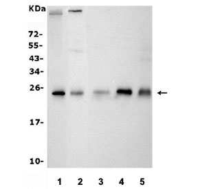 Western blot testing of 1) rat thymus, 2) rat lung, 3) mouse spleen, 4) mouse lung and 5) mouse HEPA1-6 lysate with Cd9 antibody. Expected molecular weight: ~23-27 kDa.