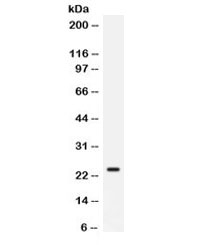 Western blot testing of mouse kidney with Cd9 antibody. Expected molecular weight: ~23-27 kDa.