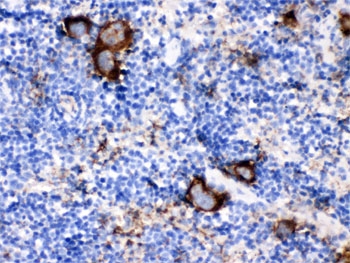 IHC testing of FFPE mouse spleen with Cd9 antibody. HIER: Boil the paraffin sections in pH 6, 10mM citrate buffer for 20 minutes and allow to cool prior to testing.