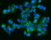 Immunofluorescent staining of FFPE mouse HEPA1-6 cells with Cd9 antibody (green) and DAPI nuclear stain (blue). HIER: steam section in pH6 citrate buffer for 20 min.