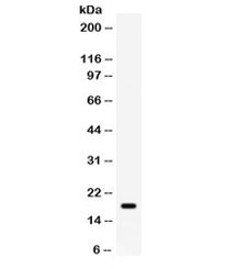 Western blot testing of human MCF7 cell lysate with GADD45A antibody. Expected/observed molecular weight ~18 kDa.