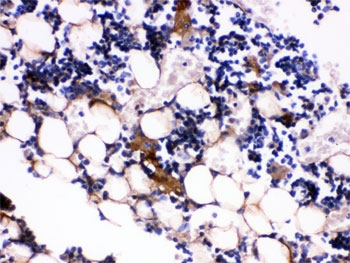 IHC testing of FFPE mouse bone tissue with Osteocalcin antibody. HIER: Boil the paraffin sections in pH 6, 10mM citrate buffer for 20 minutes and allow to cool prior to testing.