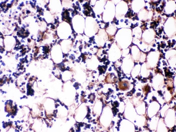 IHC testing of FFPE rat bone tissue with Osteocalcin antibody. HIER: Boil the paraffin sections in pH 6, 10mM citrate buffer for 20 minutes and allow to cool prior to testing.~