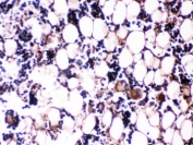 IHC testing of FFPE rat bone tissue with Osteocalcin antibody. HIER: Boil the paraffin sections in pH 6, 10mM citrate buffer for 20 minutes and allow to cool prior to testing.