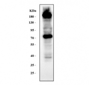 Western blot testing of mouse NIH 3T3 cell lysate with Collagen I antibody. Expected molecular weight: 140-210 kDa (precusor), 70-90 kDa (mature).