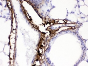 IHC testing of FFPE mouse lung with Collagen I antibody. HIER: Boil the paraffin sections in pH 6, 10mM citrate buffer for 20 minutes and allow to cool prior to testing.