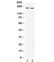 Western blot testing of 1) mouse kidney and 2) mouse heart lysate with Collagen I antibody. Expected molecular weight: 140-210 kDa (precusor), 70-90 kDa (mature).