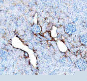IHC staining of FFPE rat kidney tissue with Collagen I antibody, HRP-secondary and DAB substrate. HIER: boil tissue sections in pH8 EDTA for 20 min and allow to cool before testing.