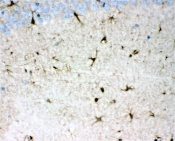 IHC staining of FFPE mosue brain with DDAH1 antibody at 1ug/ml. HIER: boil tissue sections in pH6, 10mM citrate buffer, for 10-20 min followed by cooling at RT for 20 min.