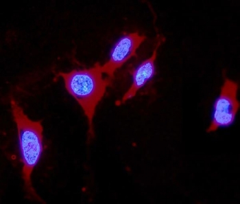 Immunofluorescent staining of FFPE human U-2 OS cells with DDAH1 antibody (red) and DAPI nuclear stain (blue). HIER: boil tissue sections in pH6, 10mM citrate buffer, for 20 min and allow to cool before testing.