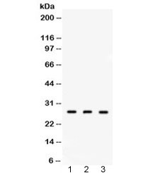 Western blot testing of 1) rat lung, 2) mouse lung and 3) human placenta lysate with DDAH2 antibody at 0.5ug/ml. Expected molecular weight ~29 kDa.
