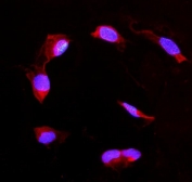 Immunofluorescent staining of FFPE human U-2 OS cells with DDAH2 antibody (red) and DAPI nuclear stain (blue). HIER: steam section in pH6 citrate buffer for 20 min.